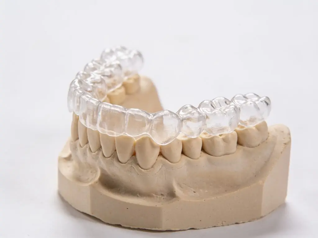 Aparelho ortodôntico em modelo dentário